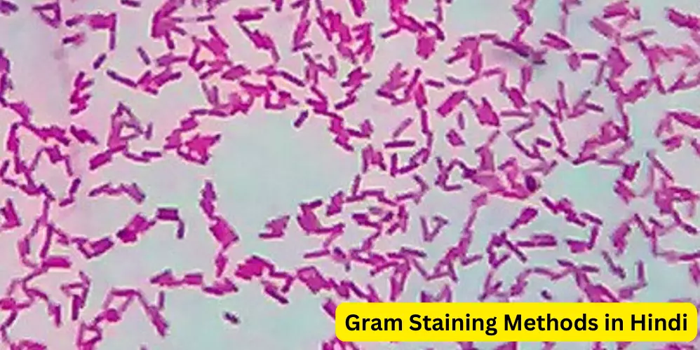 Gram Staining Methods in Hindi